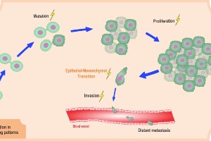 RNA and Cancer Biology
